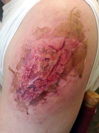 Cincinnati Makeup Artisti Jodi Byrne Special FX Burn on Arm
